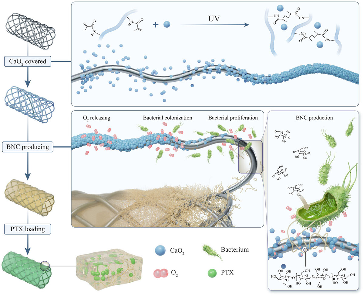 fabricating Nanocellulose-Covered Stents via In Situ Microbial Synthesis